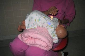 小兒拍痰與姿位引流