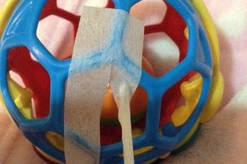 如何貼舒適不壓紅的鼻胃管貼法