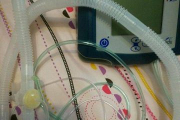 幫巴德鈕扣型胃造廔管，之灌食管換新身體