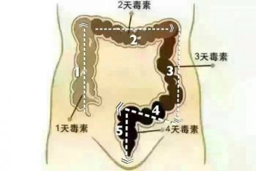 便秘、脹氣、每日攝取水分計算、幫助排便排氣食物、紅屁屁及肛裂的照護